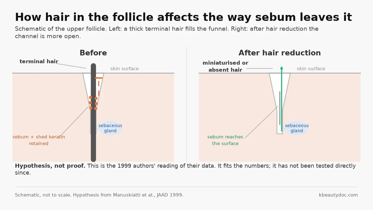 How hair in the follicle affects the way sebum leaves it