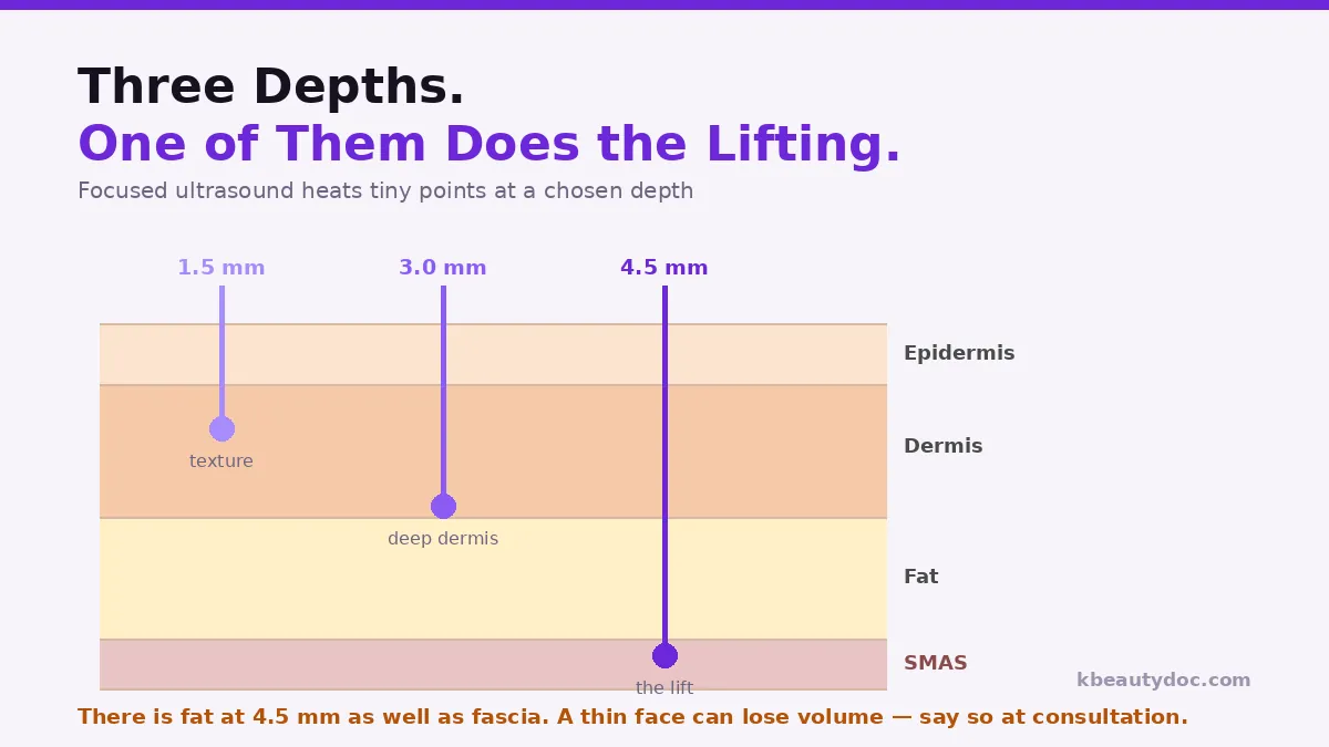 How focused ultrasound reaches the SMAS layer — depth cartridges explained