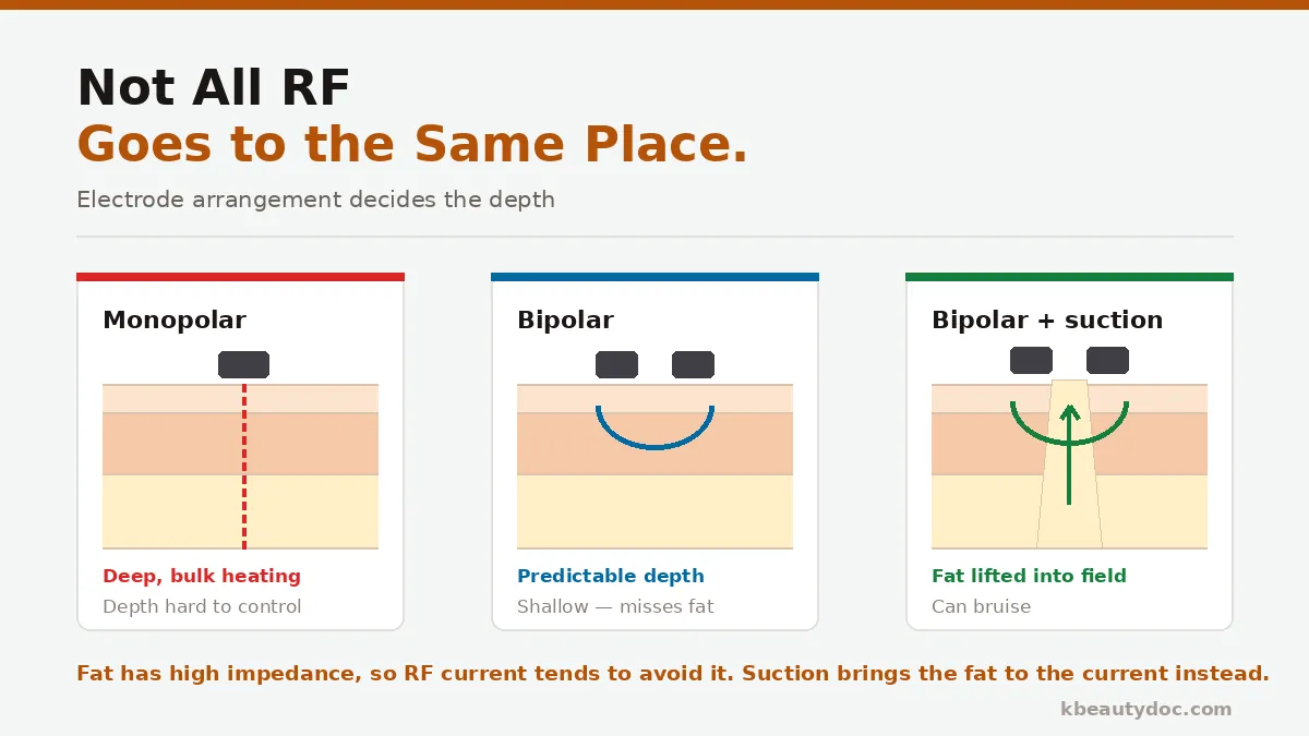 InMode vs Onda: Suction RF vs Microwave