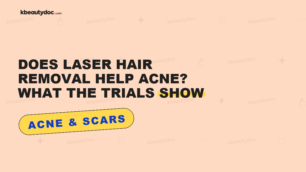 Does Laser Hair Removal Help Acne? What the Trials Show