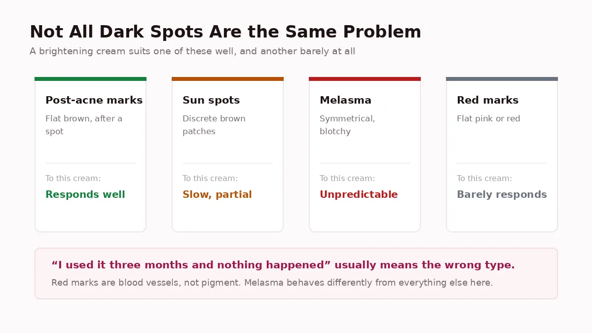 Different types of pigmentation need different approaches