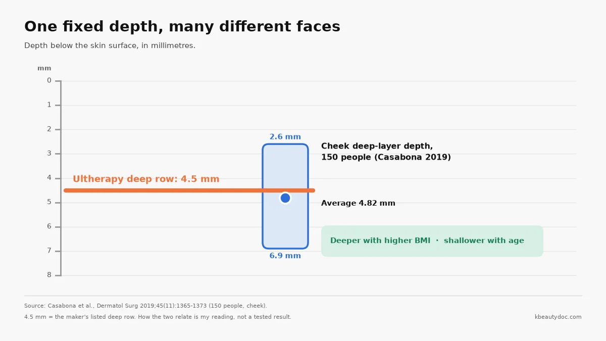 Bar chart comparing Ultherapy's fixed 4.5 mm treatment depth with the measured 2.6 to 6.9 mm range of the deep facial layer in the cheek across 150 people